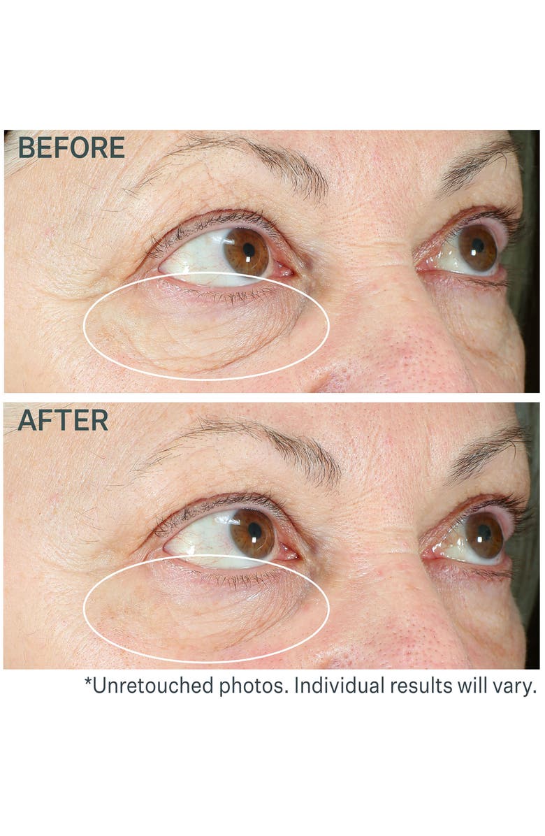 StriVectin<sup>®</sup> Hyperlift Eye<sup>™</sup> Instant Eye Fix Tightening Treatment, Alternate, color,