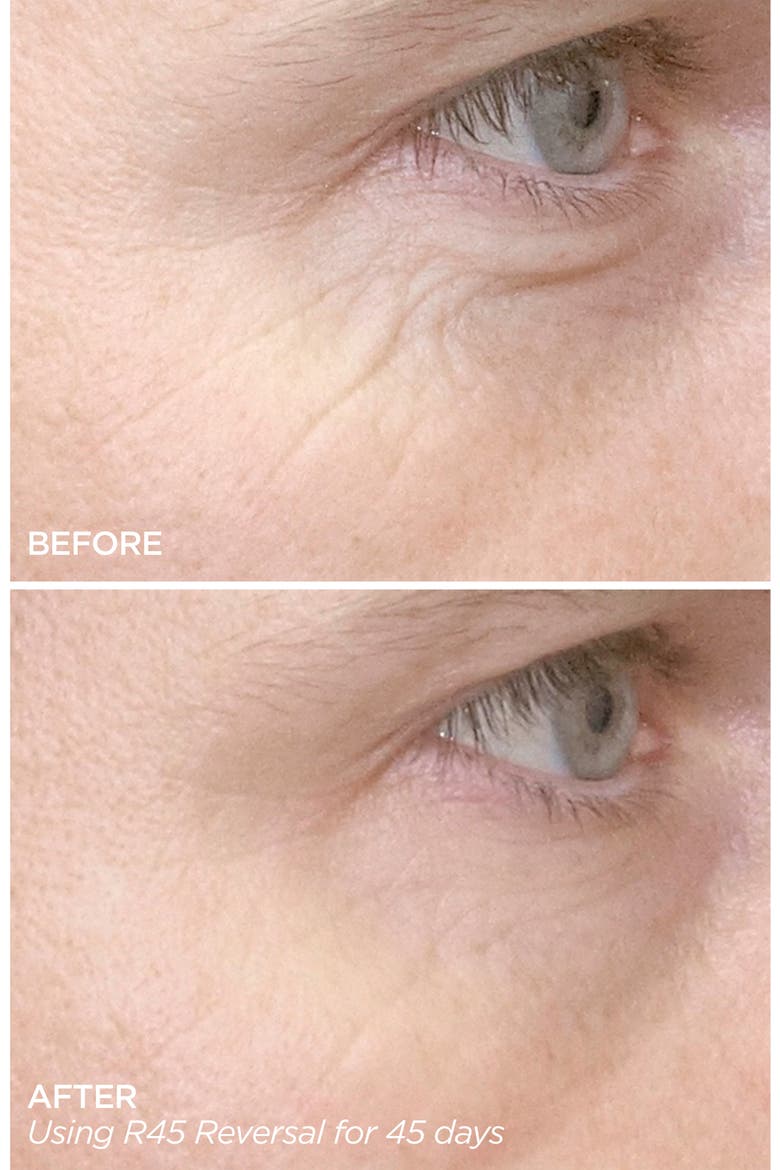 R45 The Reversal 3-Phase Skin Transforming Treatment, Alternate, color, NO COLOR