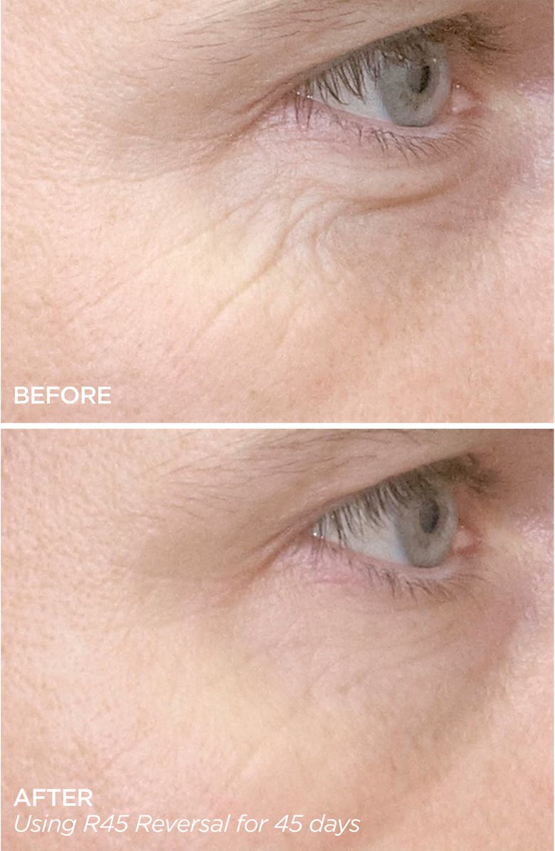 BeautyBio R45 The Reversal 3-Phase Skin Transforming Treatment, Alternate, color, 