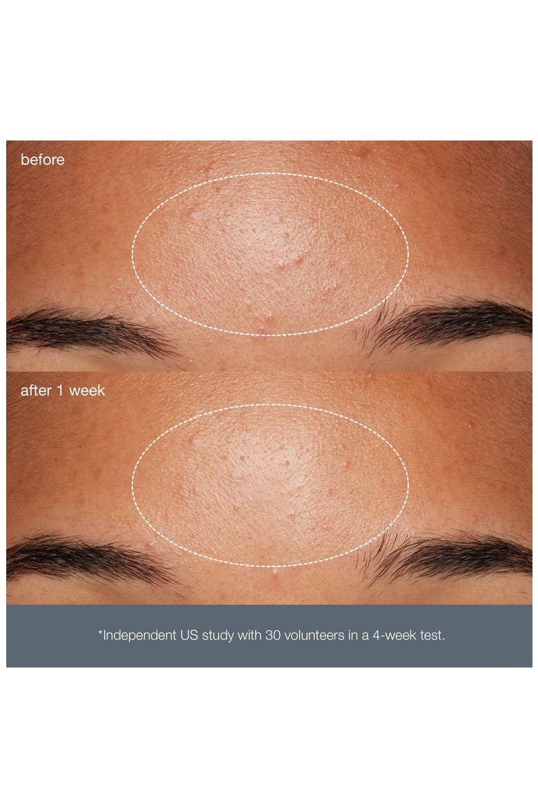 Daily Microfoliant® Exfoliator, Alternate, color, REGULAR