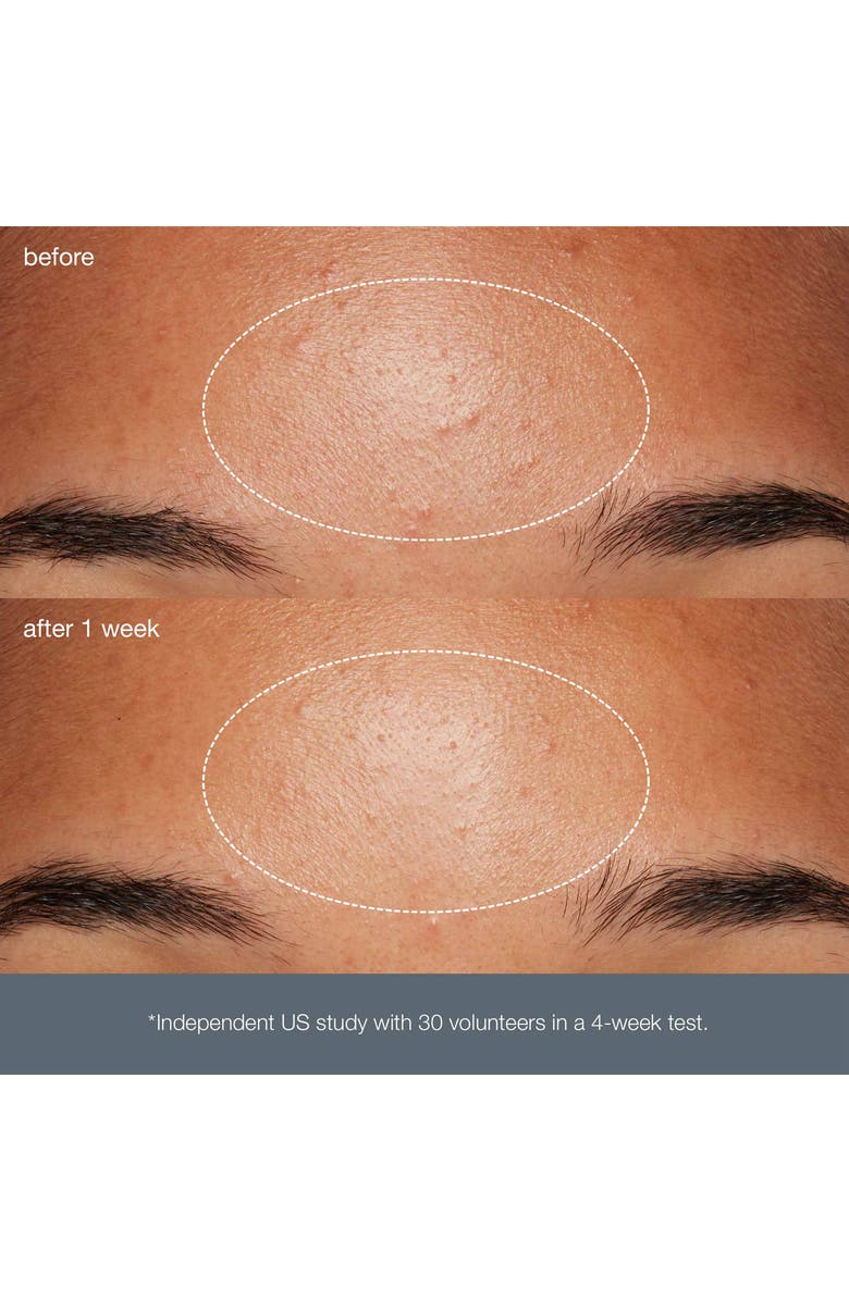 dermalogica<sup>®</sup> Daily Microfoliant<sup>®</sup> Exfoliator, Alternate, color,