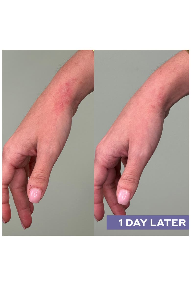 Repairing Facial Spray with Hypochlorous Acid, Alternate, color, NO COLOR