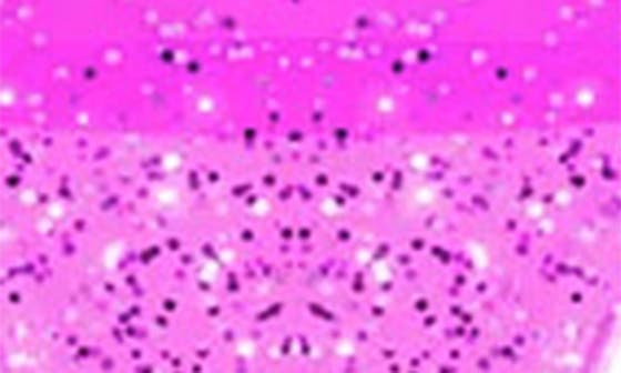 GLITTER/ ROSE QUARTZ PINK