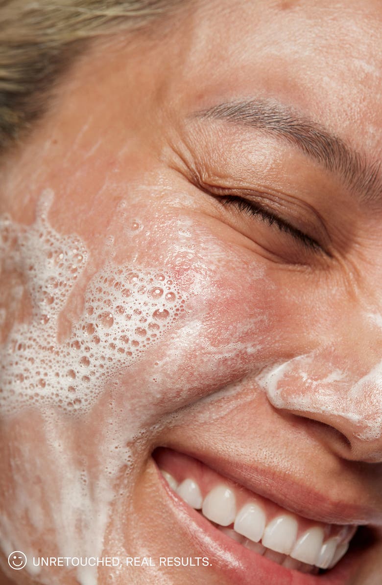 Kate Somerville<sup>®</sup> Joy to the Glow Set, Alternate, color, 