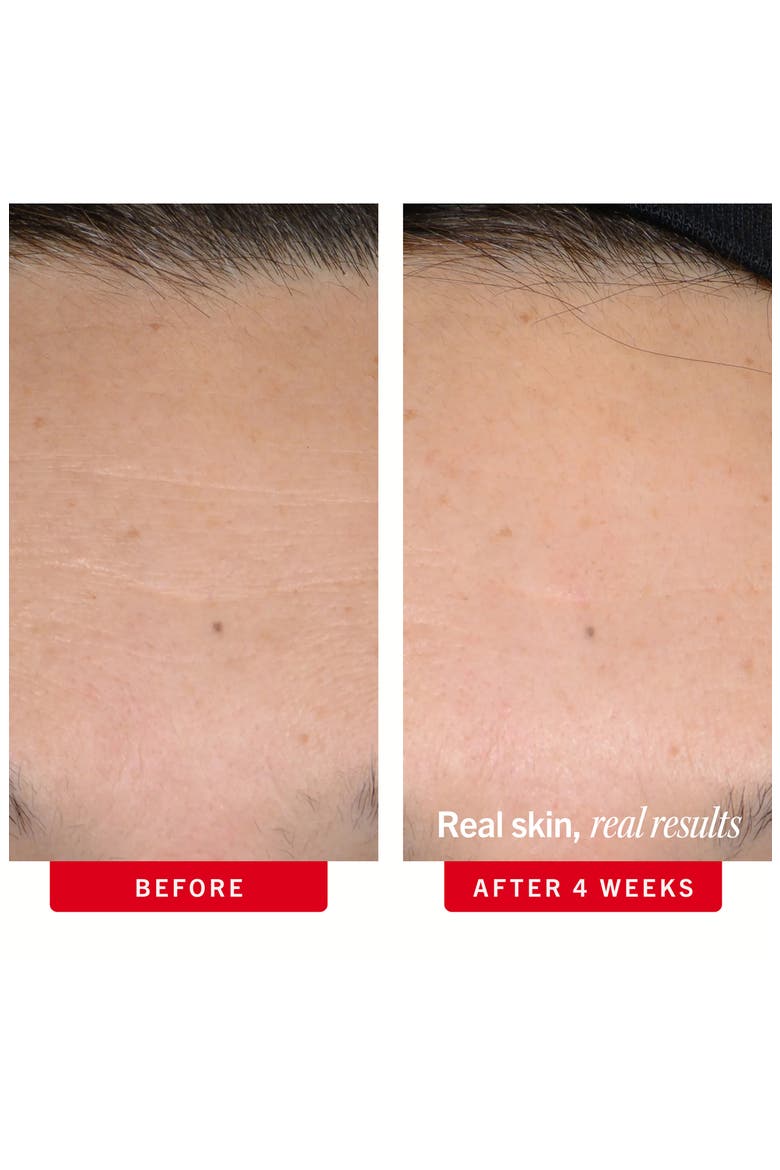 Ultra Repair Retinol Serum with 0.3% Retinol Complex & Peptides, Alternate, color, NO COLOR