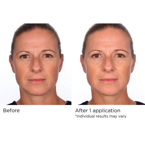 DR. NASSIF SKINCARE DR. NASSIF SKINCARE HYDRO-SCREEN SERUM