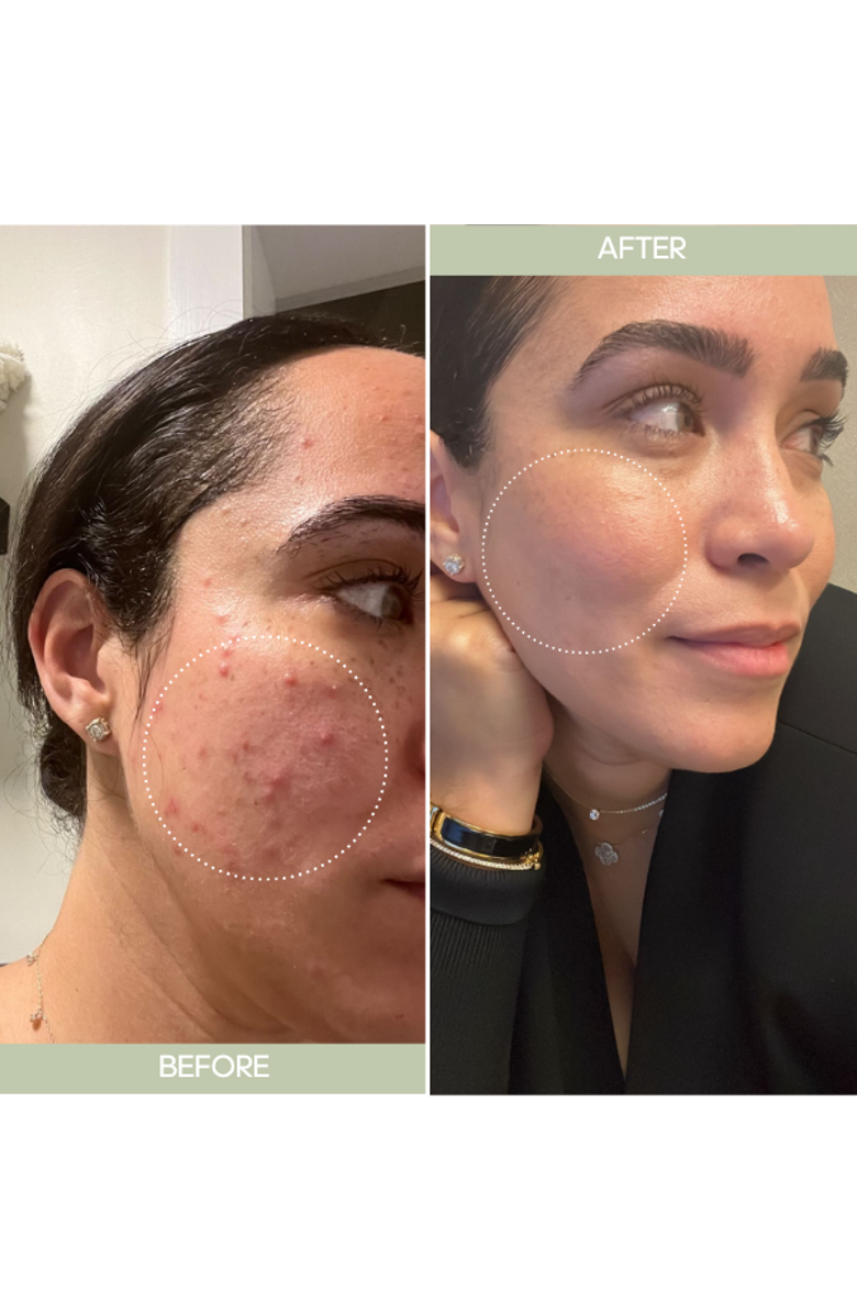 Skinergy Beauty Come Correct Serum, Alternate, color, 