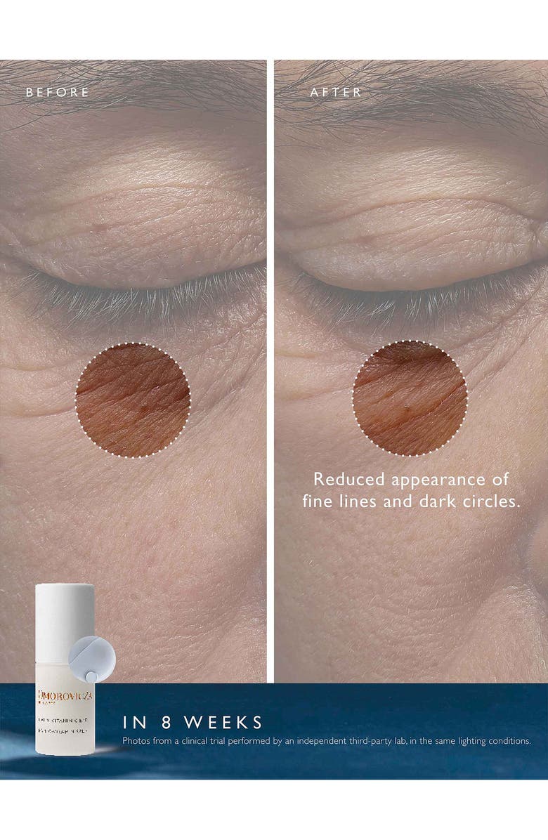 Omorovicza Daily Vitamin C Eye Serum, Alternate, color,