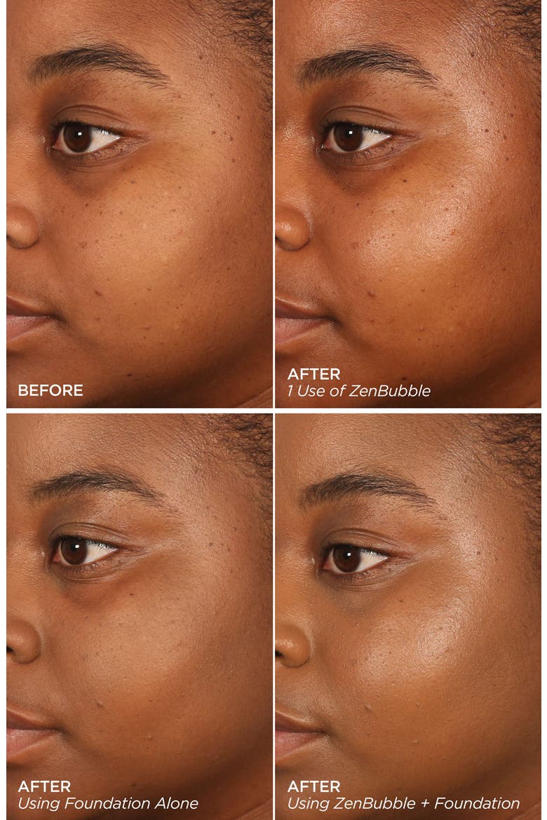 Zen Skin Duo $168 Value, Alternate, color, NO COLOR