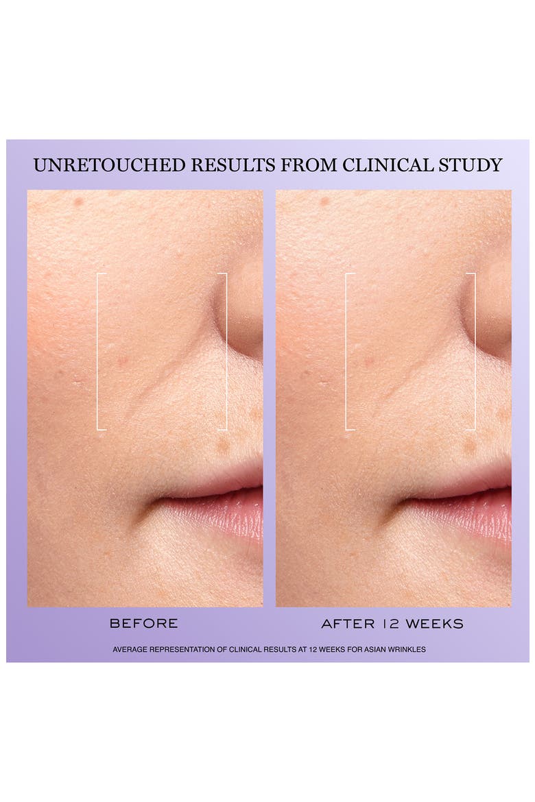 2-Piece Rénergie Collagen Cream & H.C.F. Triple Serum Set $290 Value, Alternate, color, NO COLOR