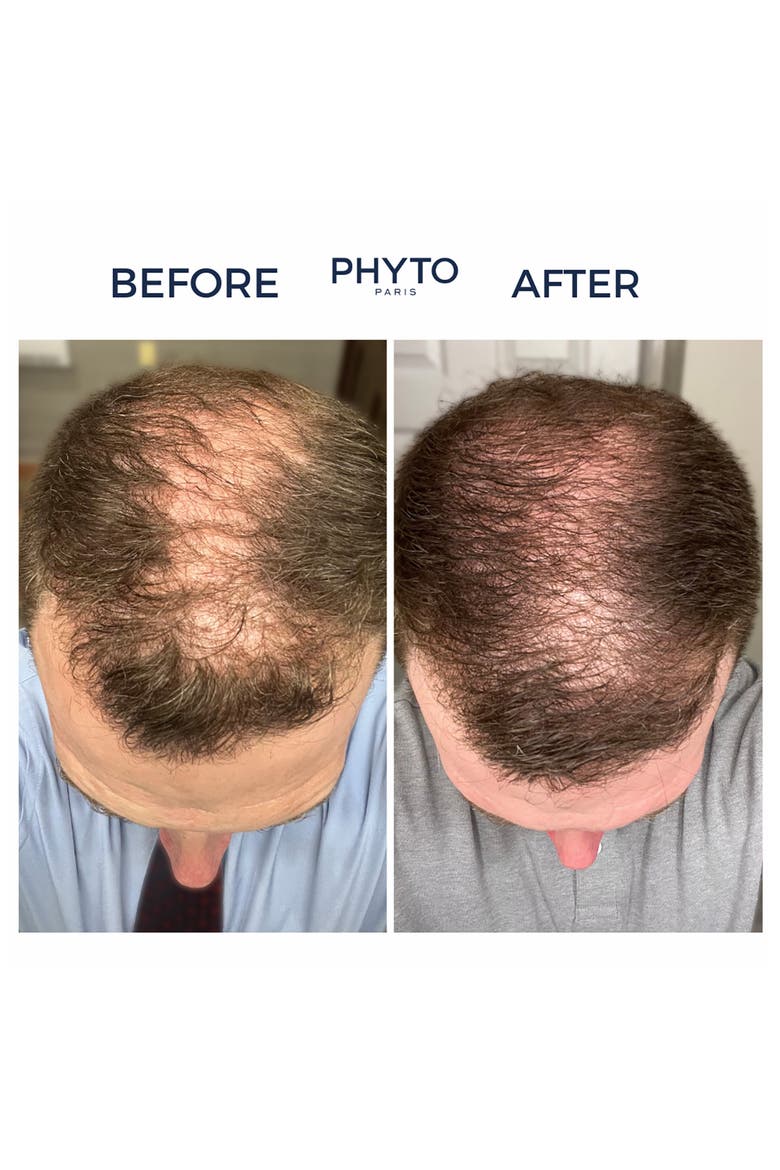Phytocyane Men Densifying Treatment for Progressive Hair Thinning, Alternate, color, NO COLOR