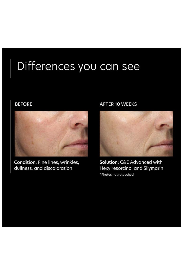 C&E Advanced with Hexylresorcinol and Silymarin Treatment Cream, Alternate, color, NO COLOR