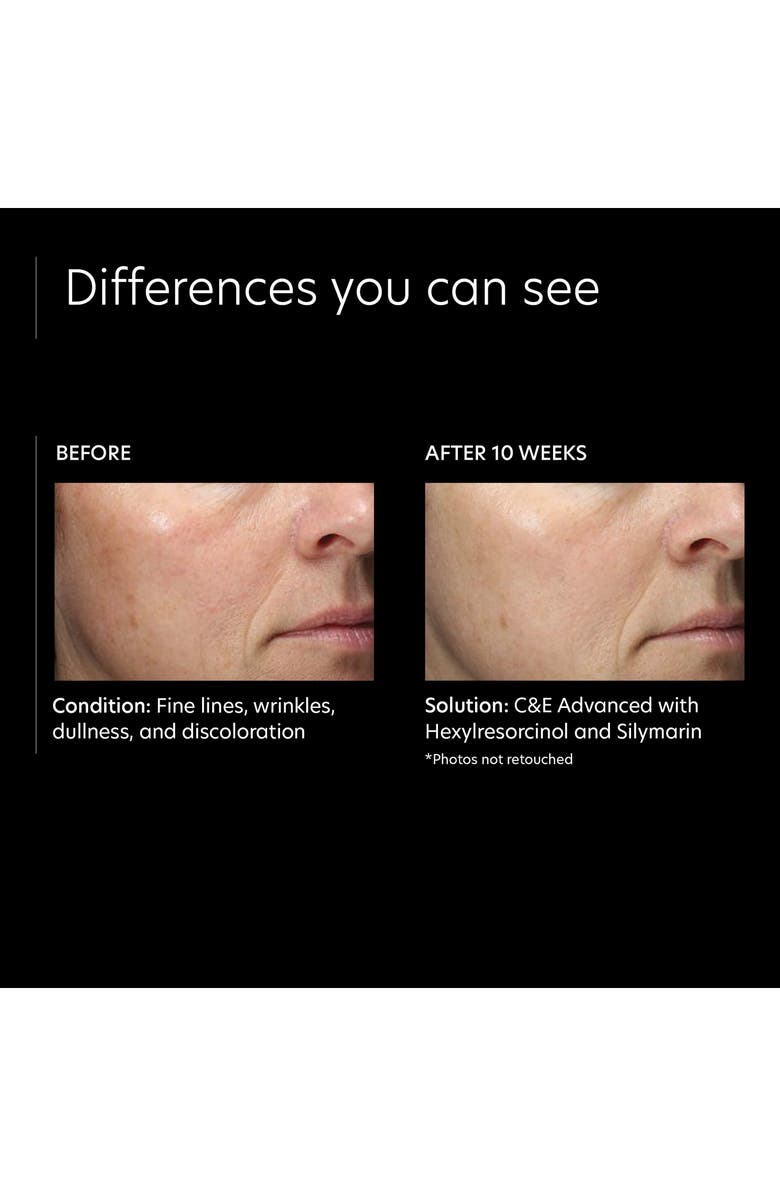 PCA Skin C&E Advanced with Hexylresorcinol and Silymarin Treatment Cream, Alternate, color,