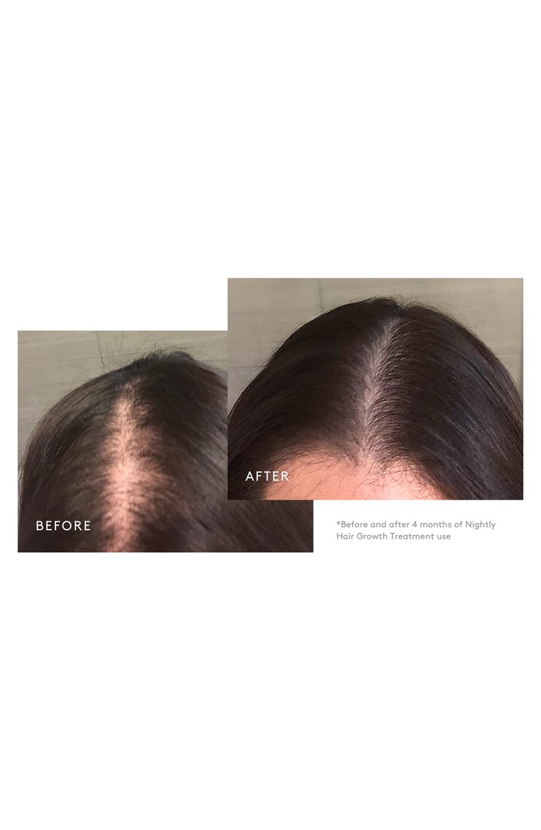 Virtue<sup>®</sup> Flourish<sup>®</sup> Hair Growth Treatment for Moderate to Severe Hair Loss, Alternate, color, 