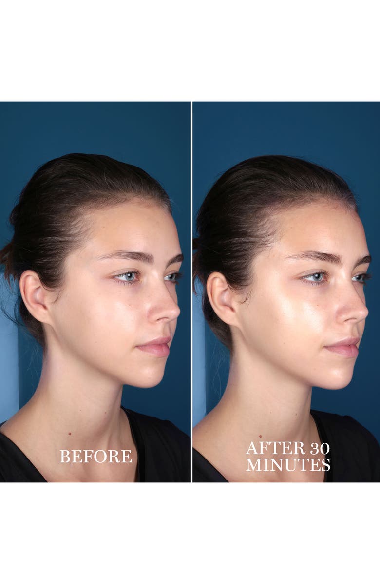 Lancôme Advanced Génifique Hydrogel Melting Sheet Mask, Alternate, color,