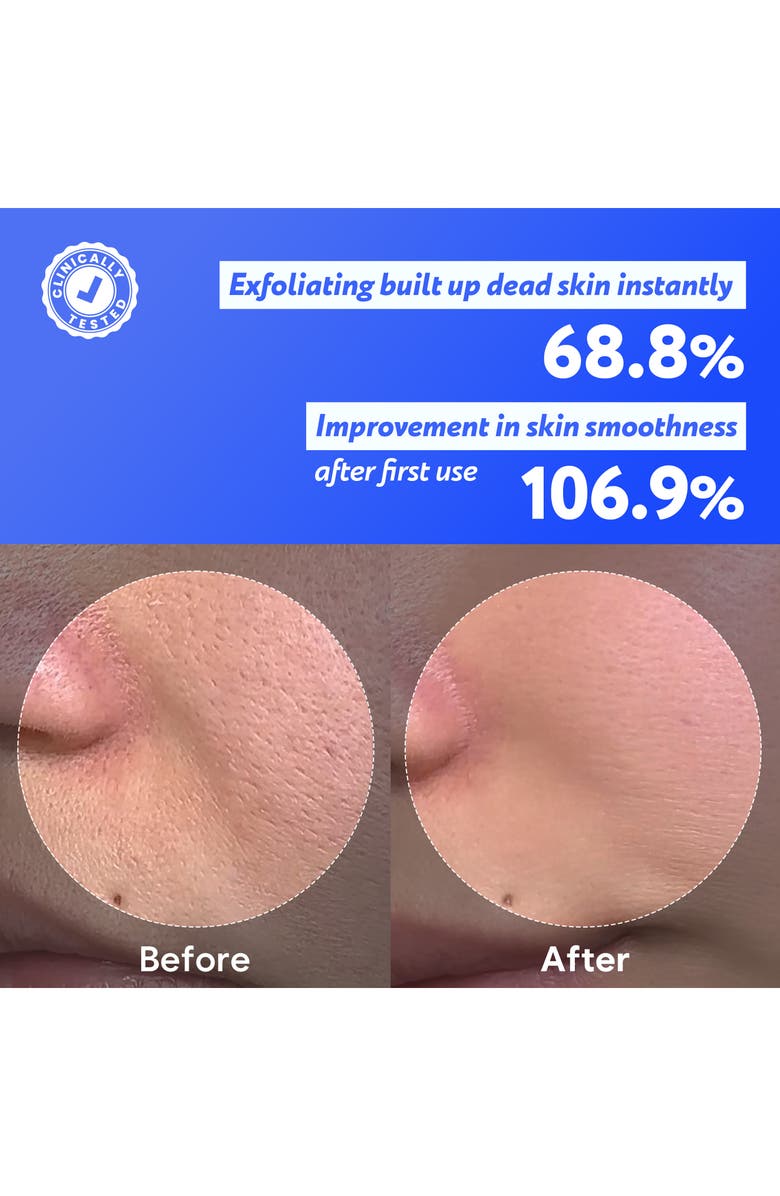Soonding <p>COconut Jelly Pore Cleanser</p>, Alternate, color, 