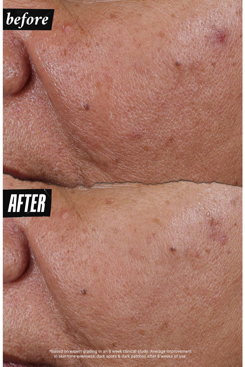 Auto-Tone Discoloration & UV Solution, Alternate, color, NO COLOR