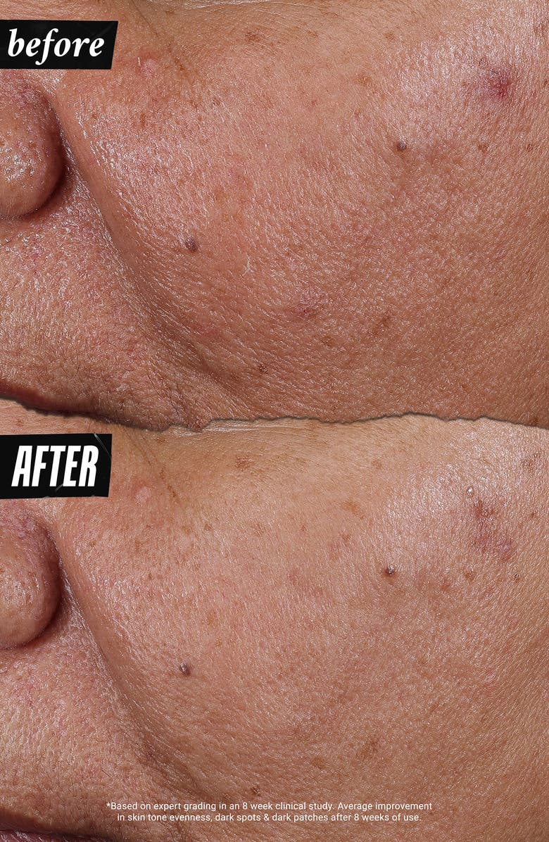 Kiehl's Since 1851 Auto-Tone Discoloration & UV Solution, Alternate, color,