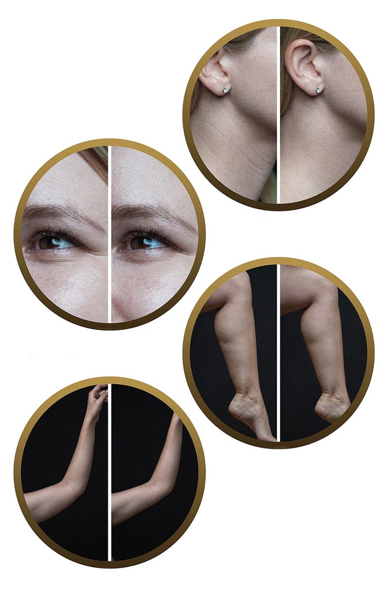 PURE DAILY CARE DermaWave Clinical Radio Frequency Skin Tightening Machine, Alternate, color, 