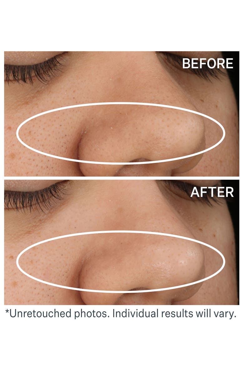 StriVectin<sup>®</sup> Daily Reveal<sup>™</sup> Exfoliating Pads, Alternate, color,