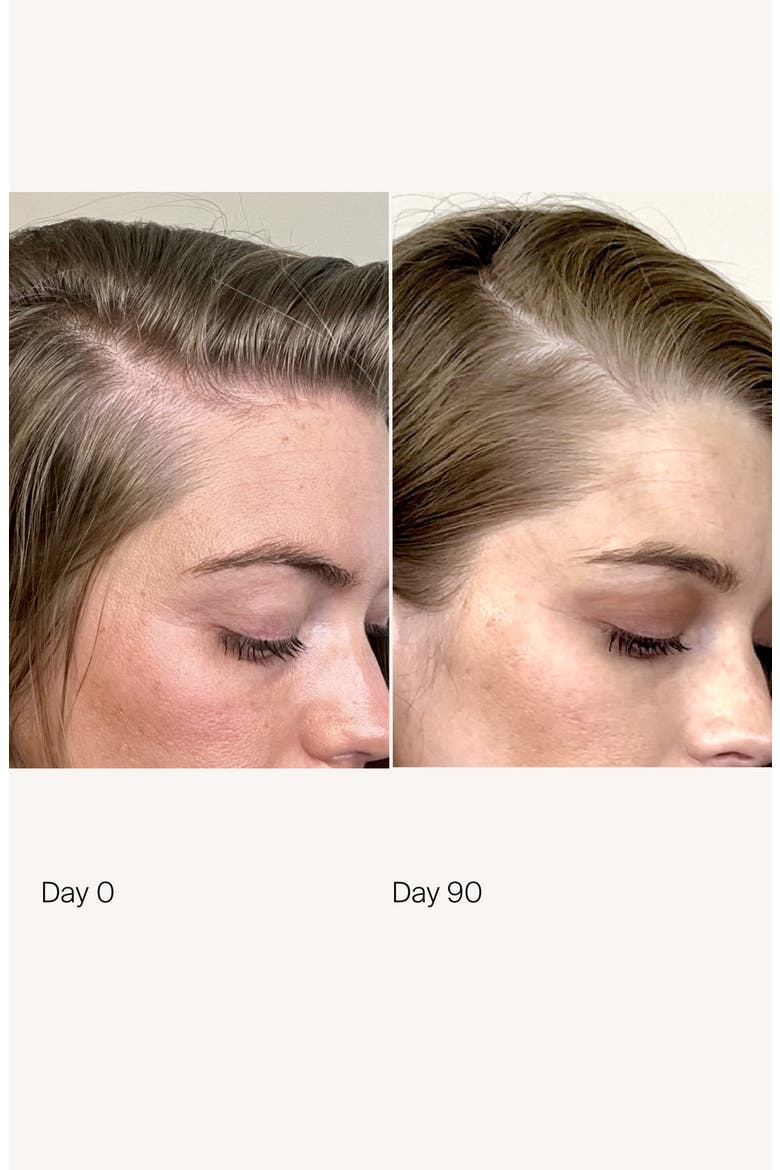 Scalp Care Density Serum, Alternate, color, NO COLOR