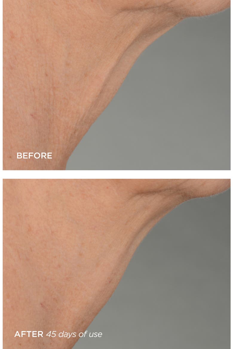 R45 The Lift 3-Phase Advanced Neck Contouring Treatment (Nordstrom Exclusive), Alternate, color, NO COLOR