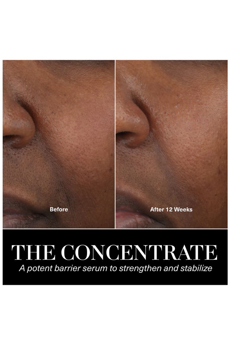 The Concentrate Serum for Barrier Repair and Hydration, Alternate, color, NO COLOR