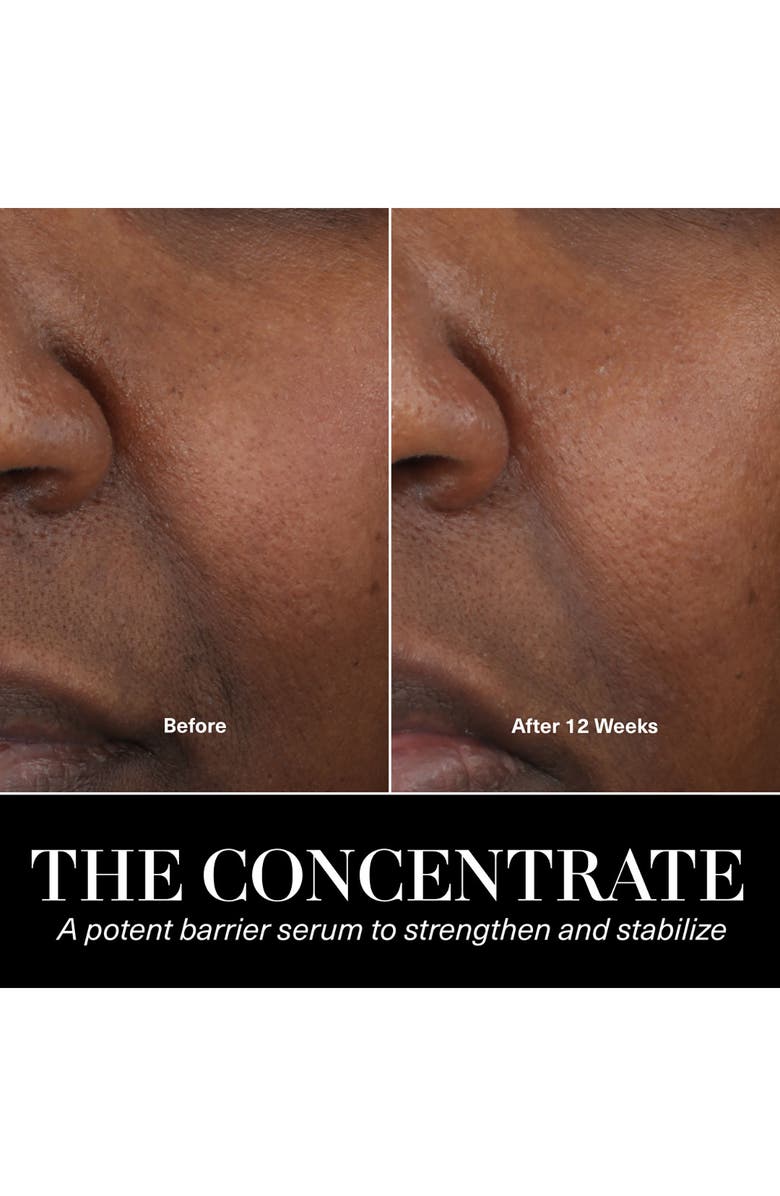La Mer The Concentrate Serum, Alternate, color,