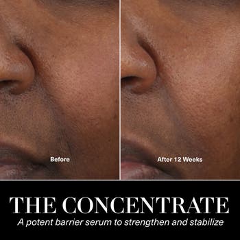 The Concentrate Serum Duo $665 Value