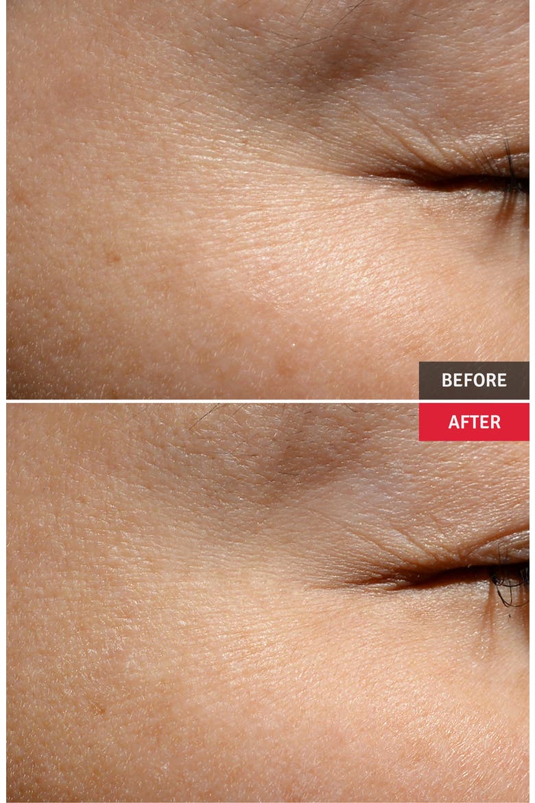 Wrinkle Serum Professional Set, Alternate, color, NO COLOR