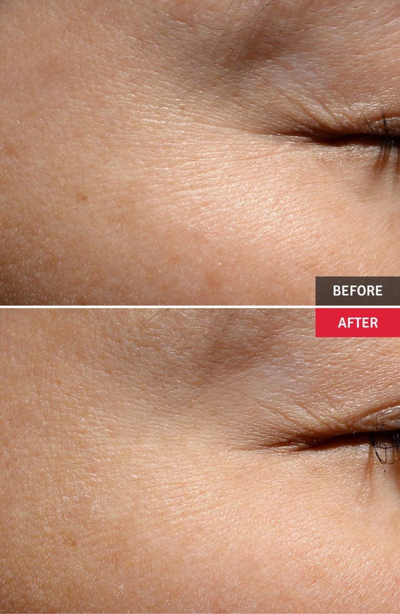 Vitabrid C12 Wrinkle Serum Professional Set, Alternate, color,