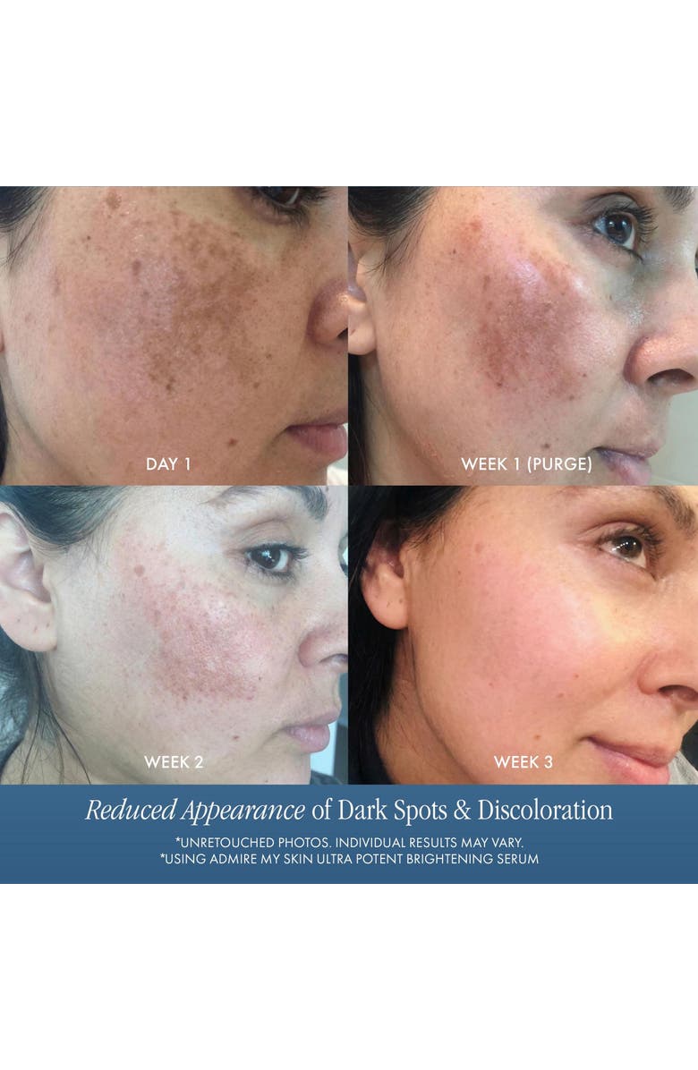 Admire My Skin Ultra Potent Brightening Serum Dark Spot Corrector, Alternate, color, Clear