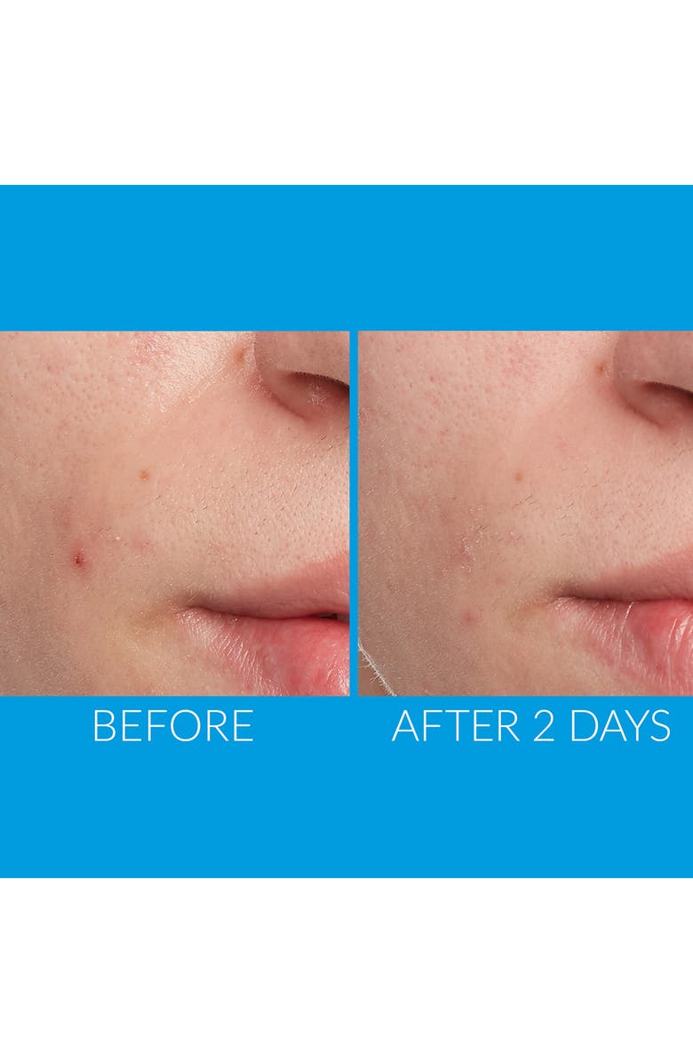 Kate Somerville<sup>®</sup> Kate's Favorite Minis Set, Alternate, color, 