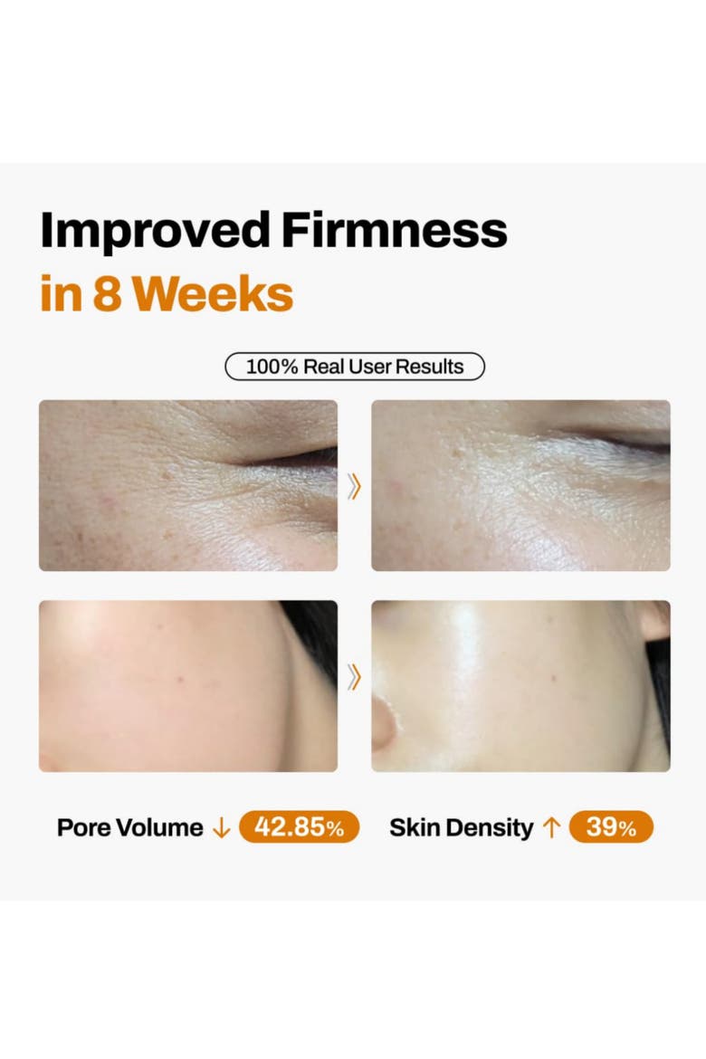 DermiShuttle Face Lifting Kit Women Daily Anti Wrinkle Care 8 Weeks, Alternate, color, No color