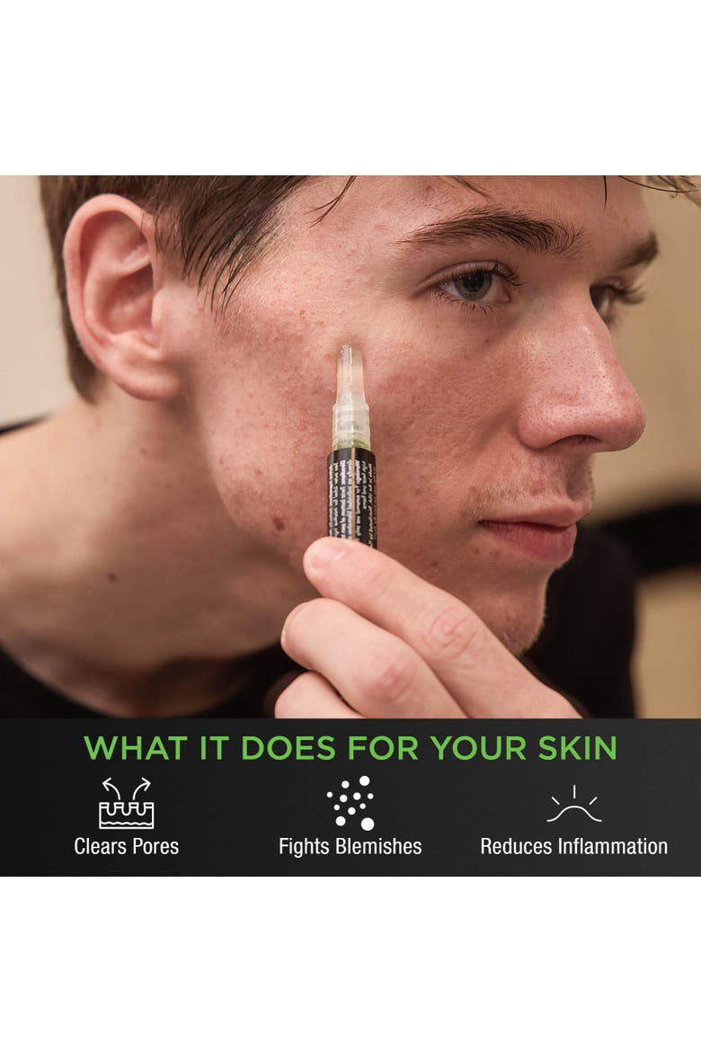 Acne Gel Pen, Alternate, color, Black