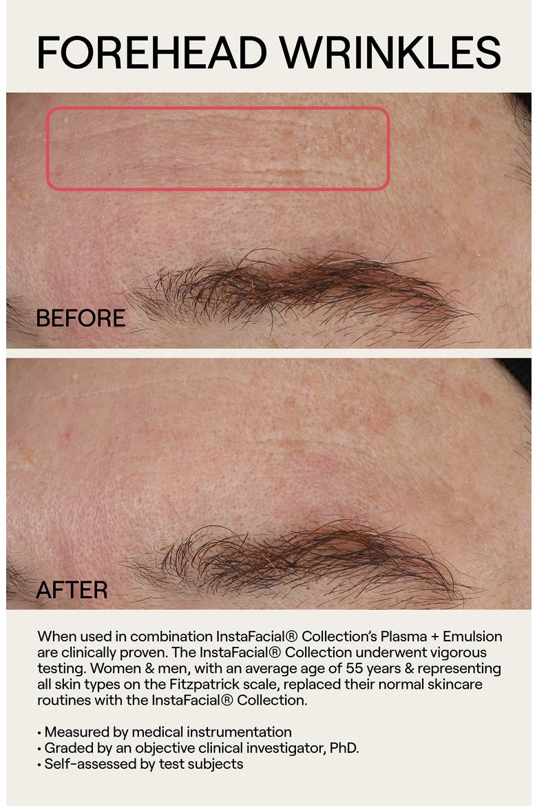 Instafacial® Plasma Bioactive Growth Factor Serum, Alternate, color, NO COLOR