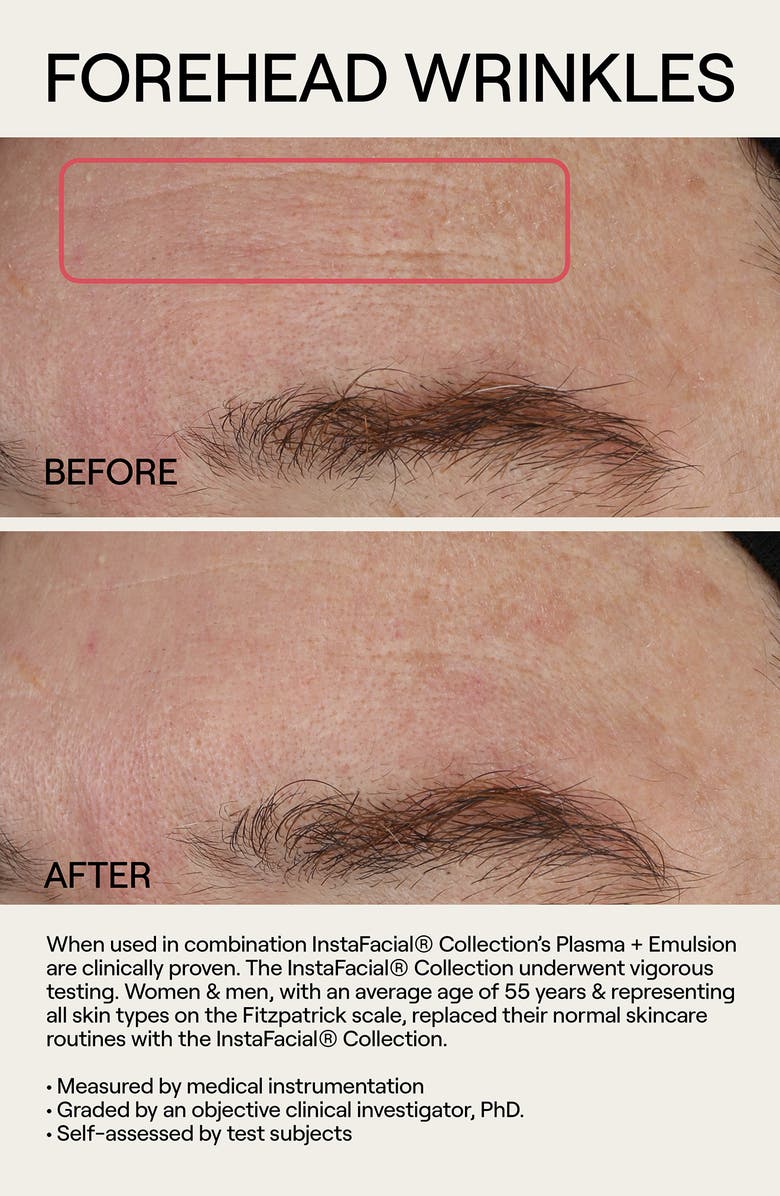 Dr. Diamond's Metacine InstaFacial<sup>®</sup> Emulsion Retinopro Growth Factor Night Cream, Alternate, color, 