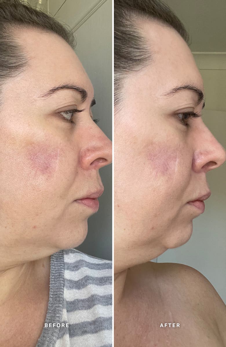 Alpha-H Vitamin A Serum with 0.5% Retinol, Alternate, color,