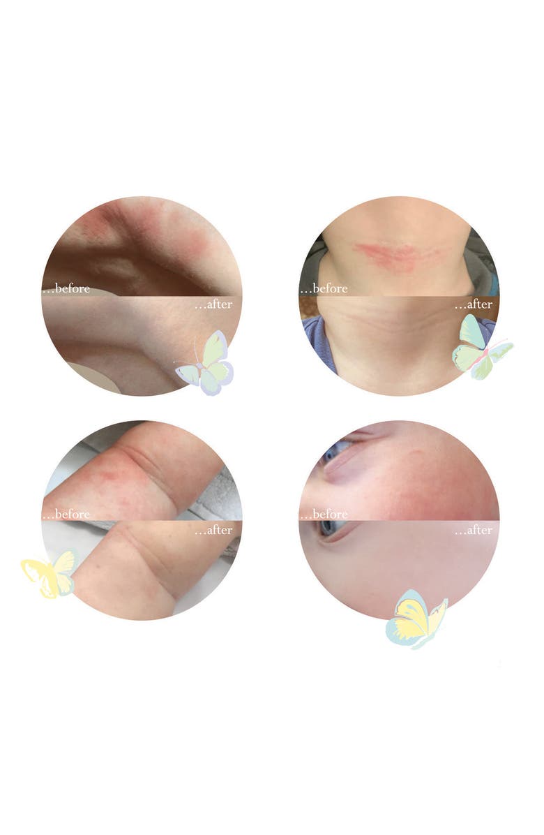 Little Butterfly London Wrapped in Love Calming Anti-Pollution Baby Face Cream 50ml, Alternate, color, Baby Face Cream 50Ml