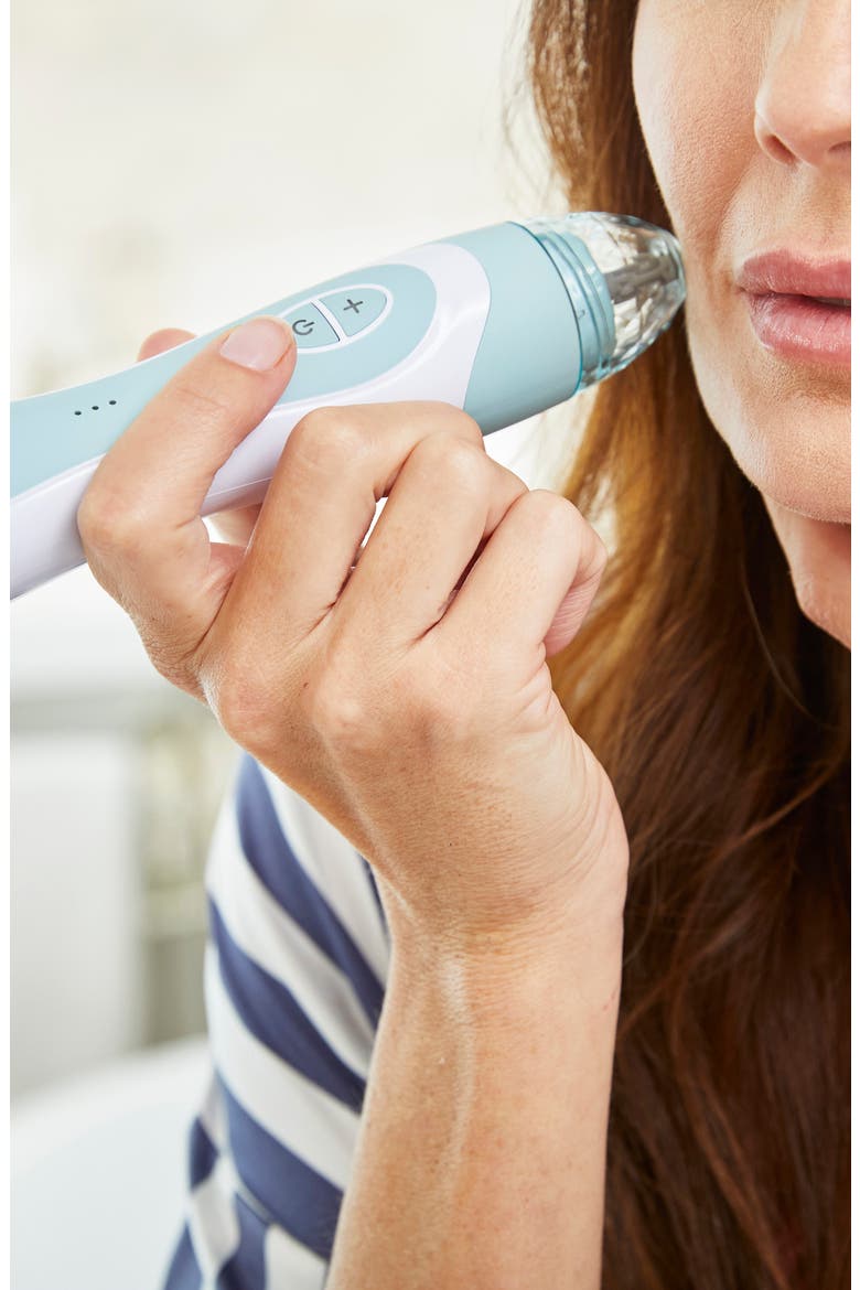 Personal Microderm Elite Pro Exfoliation Device, Alternate, color, SKY