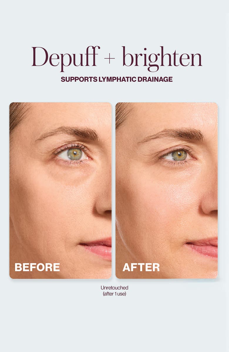 DERMAFLASH <sup>®</sup> Cool Sonic Depuffing Tool, Alternate, color, 