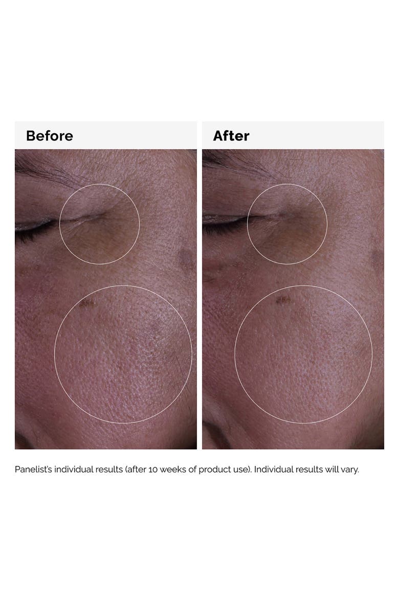 The Ordinary Multi-Peptide Serum for Hair Density for Thicker Hair, Alternate, color, 