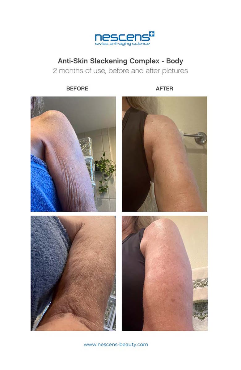 Nescens Anti-Skin Slackening Body Complex, Alternate, color, 