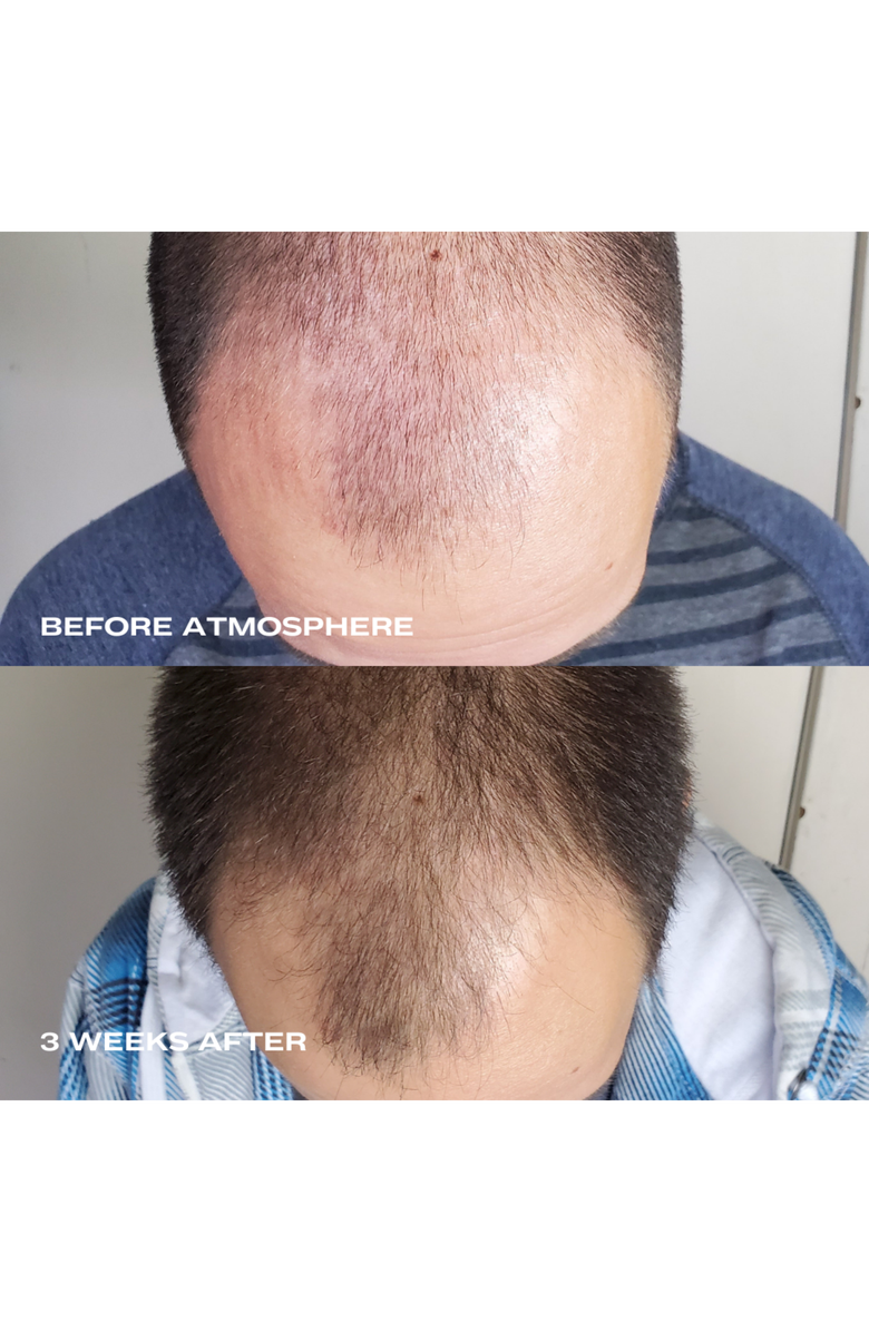 Luna Nectar Atmosphere Multi-Peptide Hair Density & Scalp Serum, Alternate, color, 1.69 Oz.