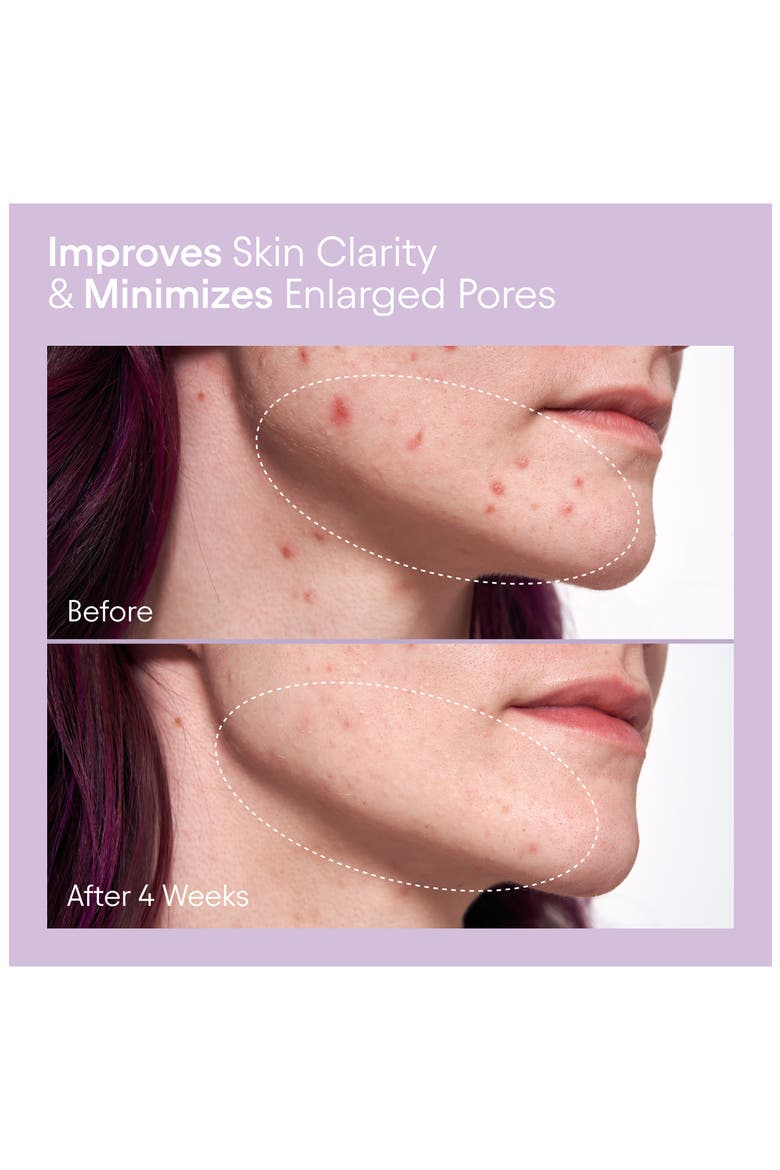 Pore Perfecting Liquid with 2% BHA & Borage, Alternate, color, NO COLOR