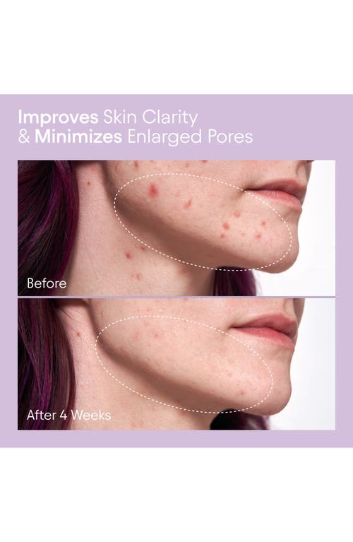 Alpyn Pore Perfecting Liquid With 2% Bha & Borage In No Color