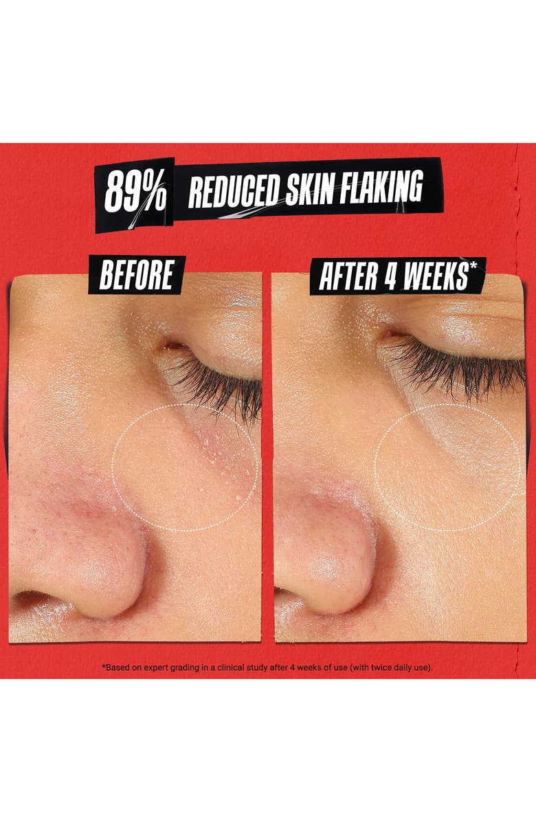 Kiehl's Since 1851 Ultra Facial Meltdown Recovery Cream, Alternate, color, 