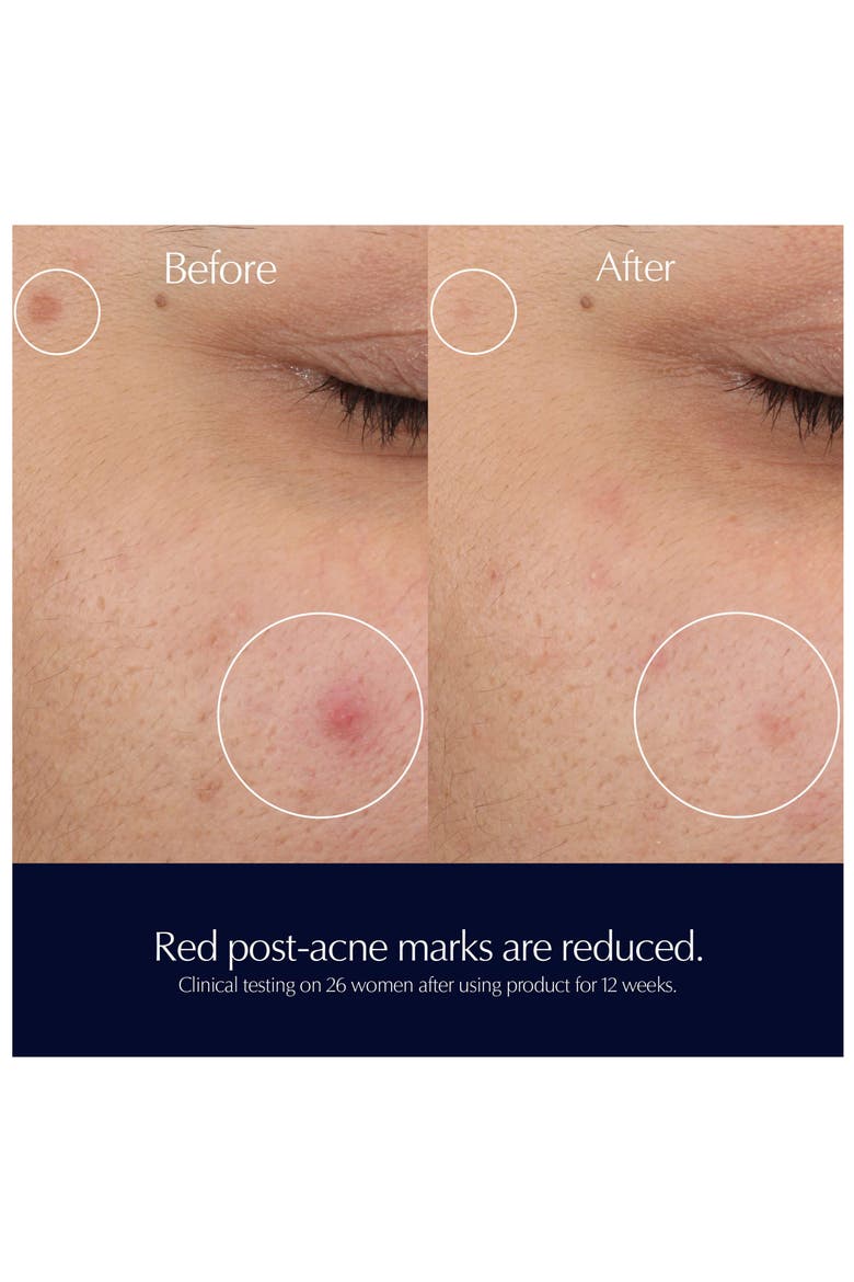 Advanced Night Repair Rescue Solution Face Serum with 15% Bifidus Ferment, Alternate, color, NO COLOR