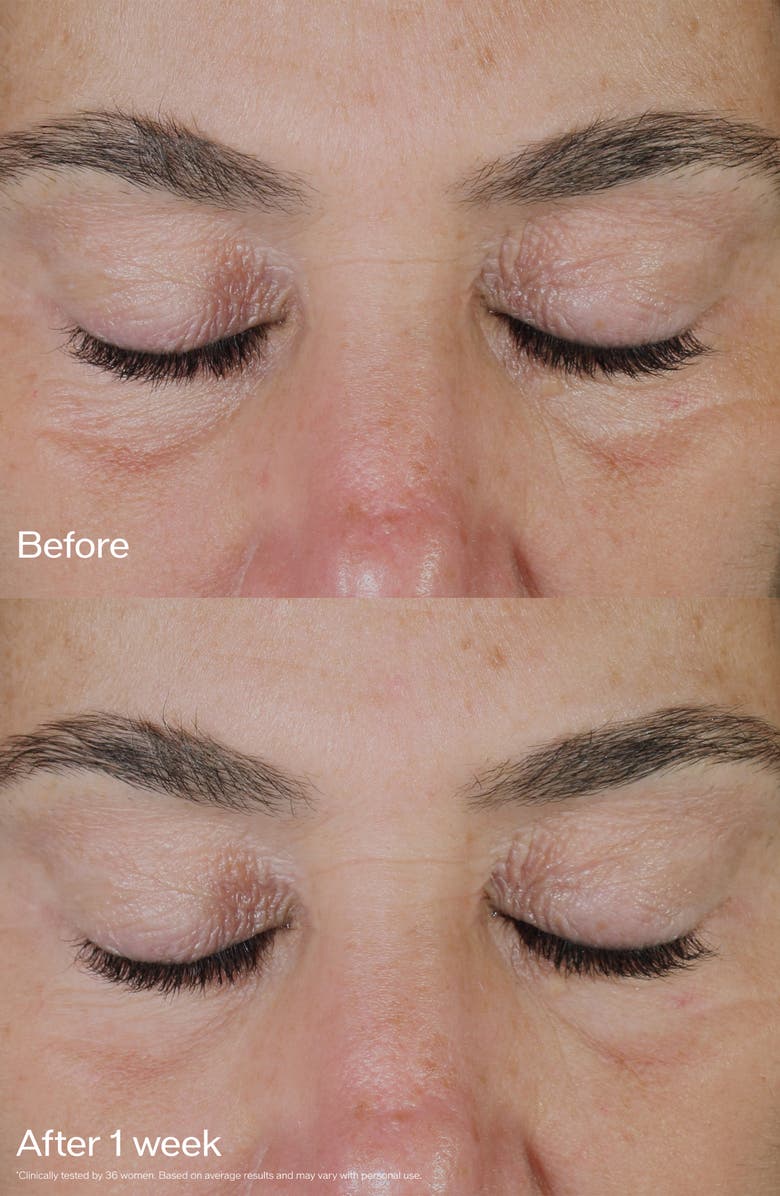 Shiseido Vital Perfection Uplifting and Firming Eye Cream, Alternate, color,