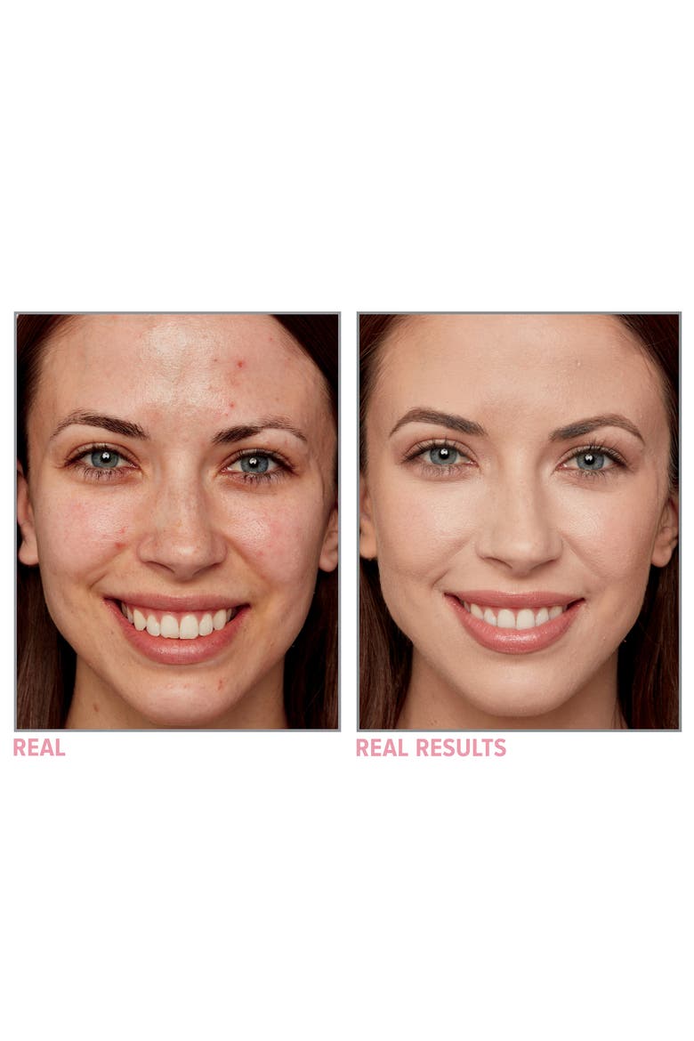 Bye Bye Breakout Full-Coverage Concealer, Alternate, color, RICH